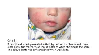 Approach to the patient with pruritus | PPTX