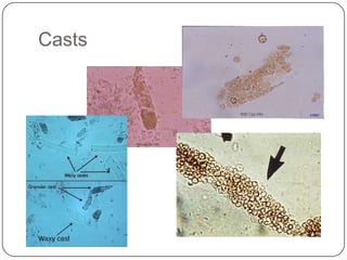 Approach to the Patient with Renal Disease | PPTX