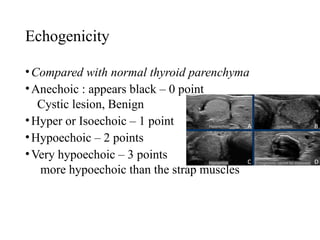 Comprehensive Approach to Thyroid Swelling: Diagnosis and Management | PPTX
