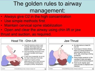 The golden rules to airway
management:
1/25/2023
• Always give O2 in the high concentration
• Use simple methods first.
• Maintain cervical spine stabilization
• Open and clear the airway using chin lift or jaw
thrust and suction, as required.
 