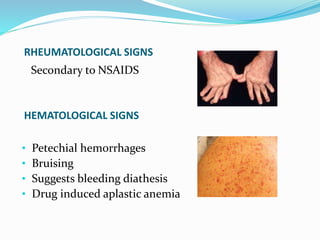 RHEUMATOLOGICAL SIGNS
Secondary to NSAIDS
HEMATOLOGICAL SIGNS
• Petechial hemorrhages
• Bruising
• Suggests bleeding diathesis
• Drug induced aplastic anemia
 