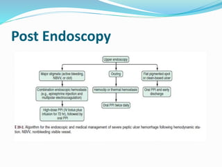 Post Endoscopy
 