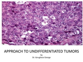 APPROACH TO UNDIFFERENTIATED TUMORS
by
Dr. Varughese George
 