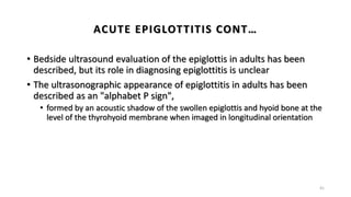 • Bedside ultrasound evaluation of the epiglottis in adults has been
described, but its role in diagnosing epiglottitis is unclear
• The ultrasonographic appearance of epiglottitis in adults has been
described as an "alphabet P sign",
• formed by an acoustic shadow of the swollen epiglottis and hyoid bone at the
level of the thyrohyoid membrane when imaged in longitudinal orientation
41
ACUTE EPIGLOTTITIS CONT…
 