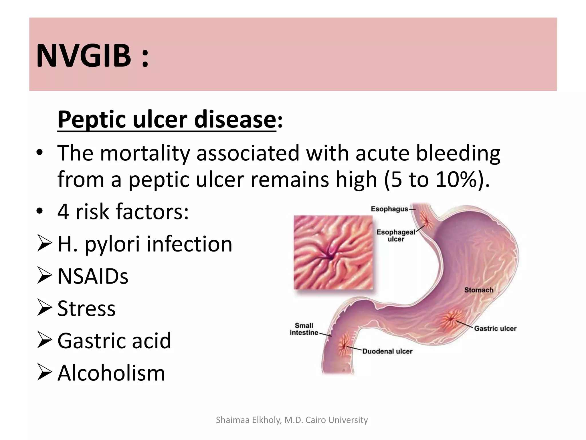 NVGIB :
Peptic ulcer disease:
• The mortality associated with acute bleeding
from a peptic ulcer remains high (5 to 10%).
• 4 risk factors:
H. pylori infection
NSAIDs
Stress
Gastric acid
Alcoholism
Shaimaa Elkholy, M.D. Cairo University
 
