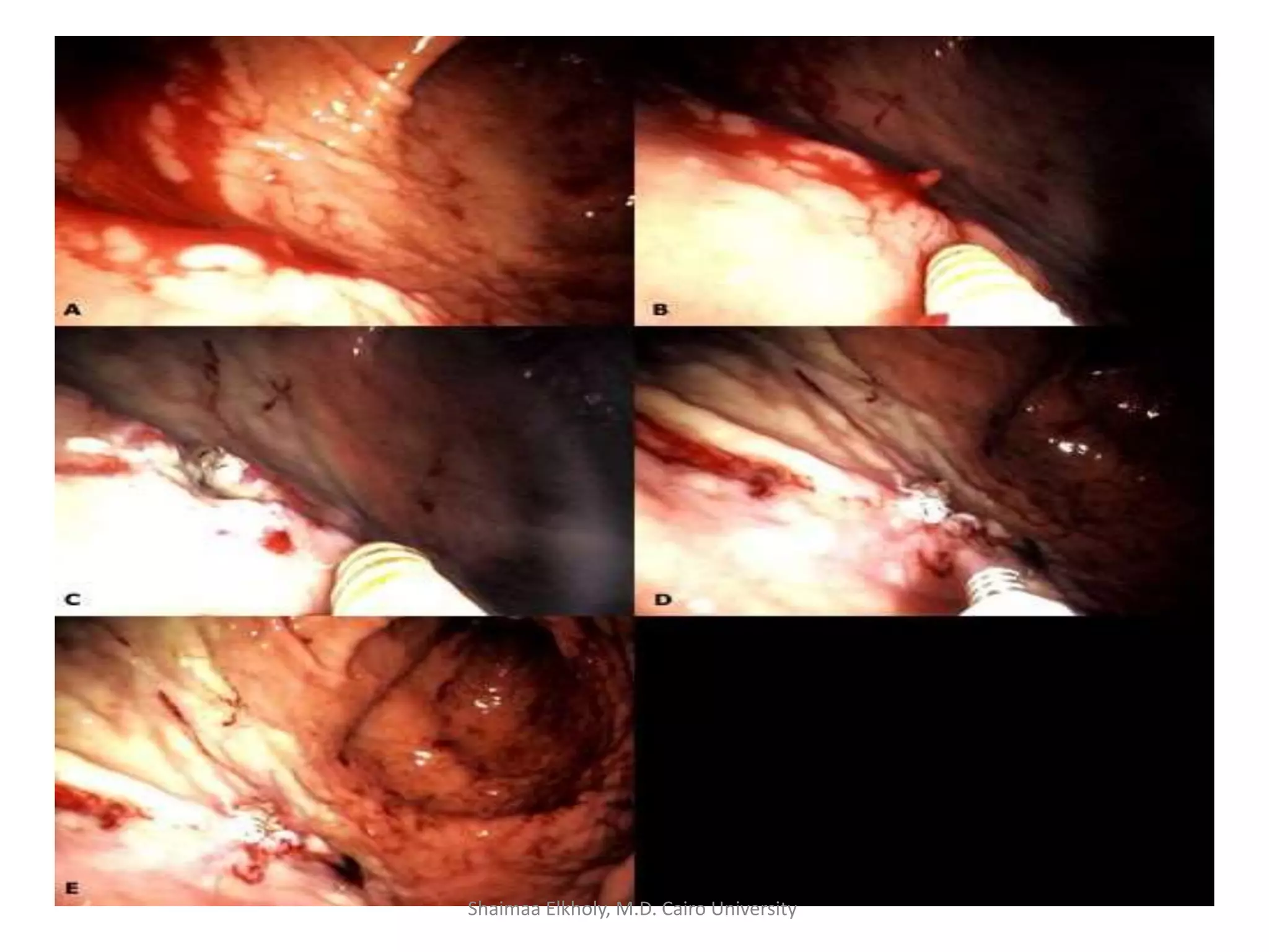 Shaimaa Elkholy, M.D. Cairo University
 