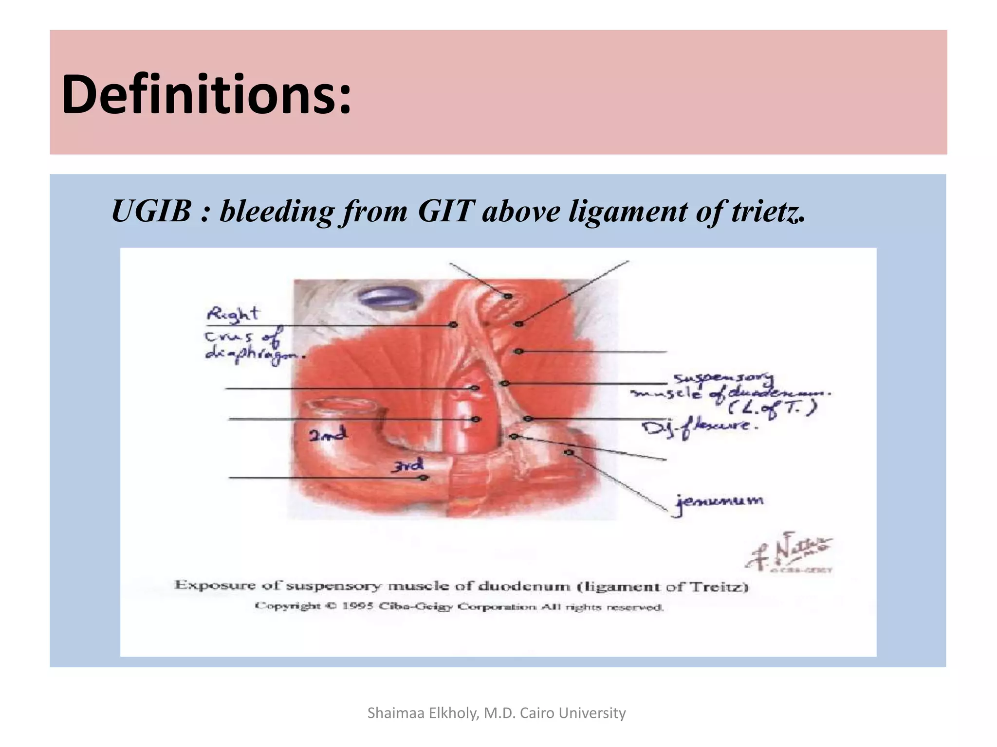 Definitions:
UGIB : bleeding from GIT above ligament of trietz.
Shaimaa Elkholy, M.D. Cairo University
 