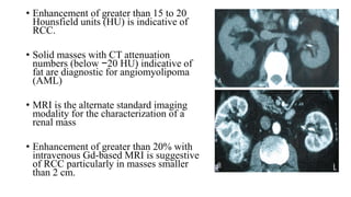 Approach to Upper Urinary Tract Tumors.pptx
