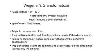 APPROACH TO VASCULITIS..........pptx