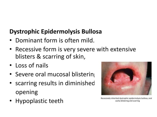 Approach to vesiculo bullous papular lesion in neonates | PPTX | Skin ...