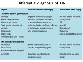 Approach to vision loss | PPTX