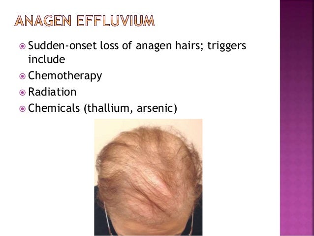 Approach To Women With Hair Loss Dr Aisha Almoosa