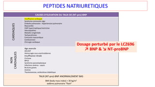PEPTIDES NATRIURETIQUES
CAUSES D’ELEVATION DU TAUX DE (NT-pro)-BNP
CARDIAQUES
Insuffisance cardiaque
Syndrome coronarien aigu
Embolie pulmonaire - Hypertension pulmonaire
Myocardite
CMP hypertrophique/restrictive
Valvulopathies
Maladie congénitale
Tachyarythmies
Contusion myocardique
Cardioversion
Chirurgie cardiaque
NON
CARDIAQUES
Age avancée
AVC/AIT
Hémorragie sous-arachnoïdienne
Insuffisance rénale
Cirrhose
BPCO
Syndrome paranéoplasique
Infections sévères - sepsis
Brulures graves
Anémie
Thyréotoxicose, acidocétose diabétique
TAUX (NT-pro)-BNP ANORMALEMENT BAS
BMI (body mass index) > 30 kg/m2
œdème pulmonaire "flash"
Dosage perturbé par le LCZ696
↗ BNP & ↘ NT-proBNP
 