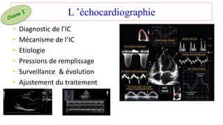 L ’échocardiographie
• Diagnostic de l’IC
• Mécanisme de l’IC
• Etiologie
• Pressions de remplissage
• Surveillance & évolution
• Ajustement du traitement
 