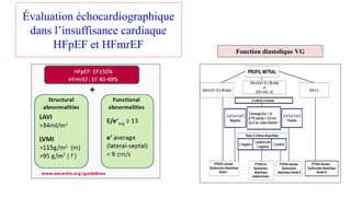Évaluation échocardiographique
dans l’insuffisance cardiaque
HFpEF et HFmrEF Fonction diastolique VG
 