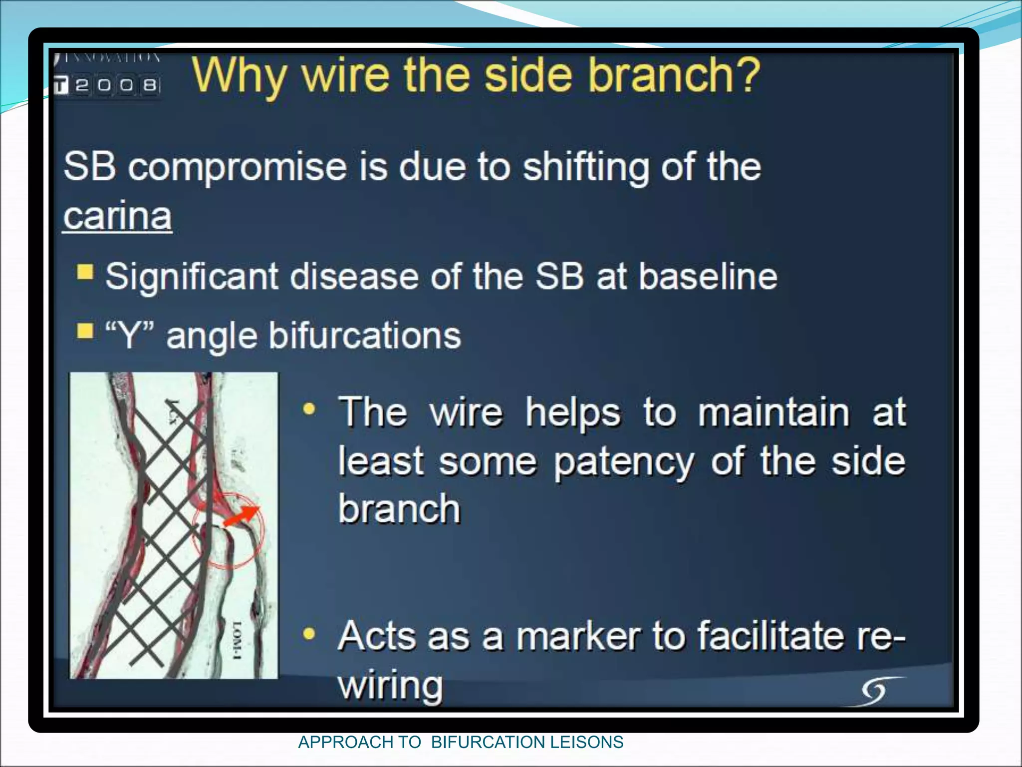APPROACH TO BIFURCATION LEISONS
 