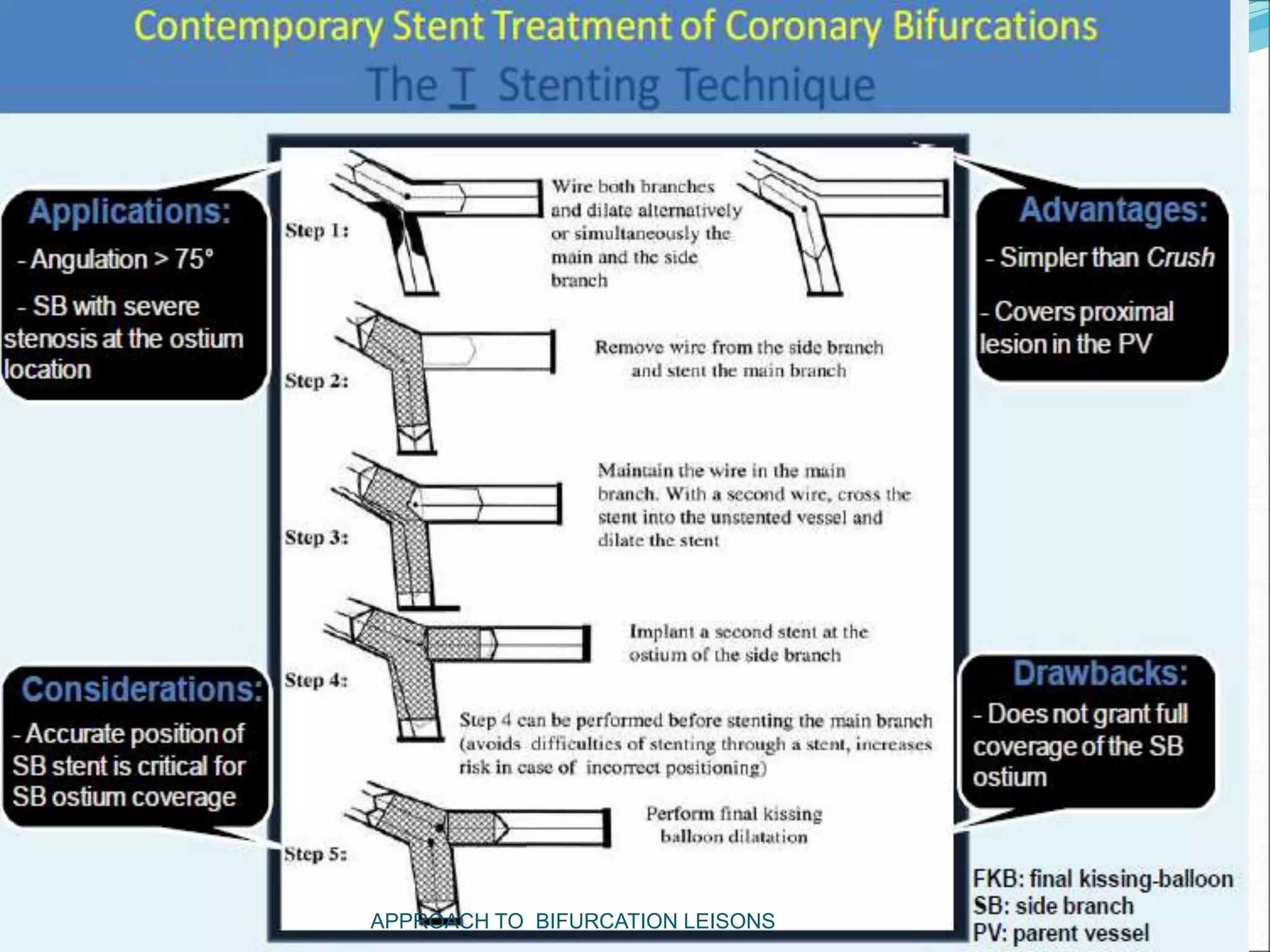 APPROACH TO BIFURCATION LEISONS
 