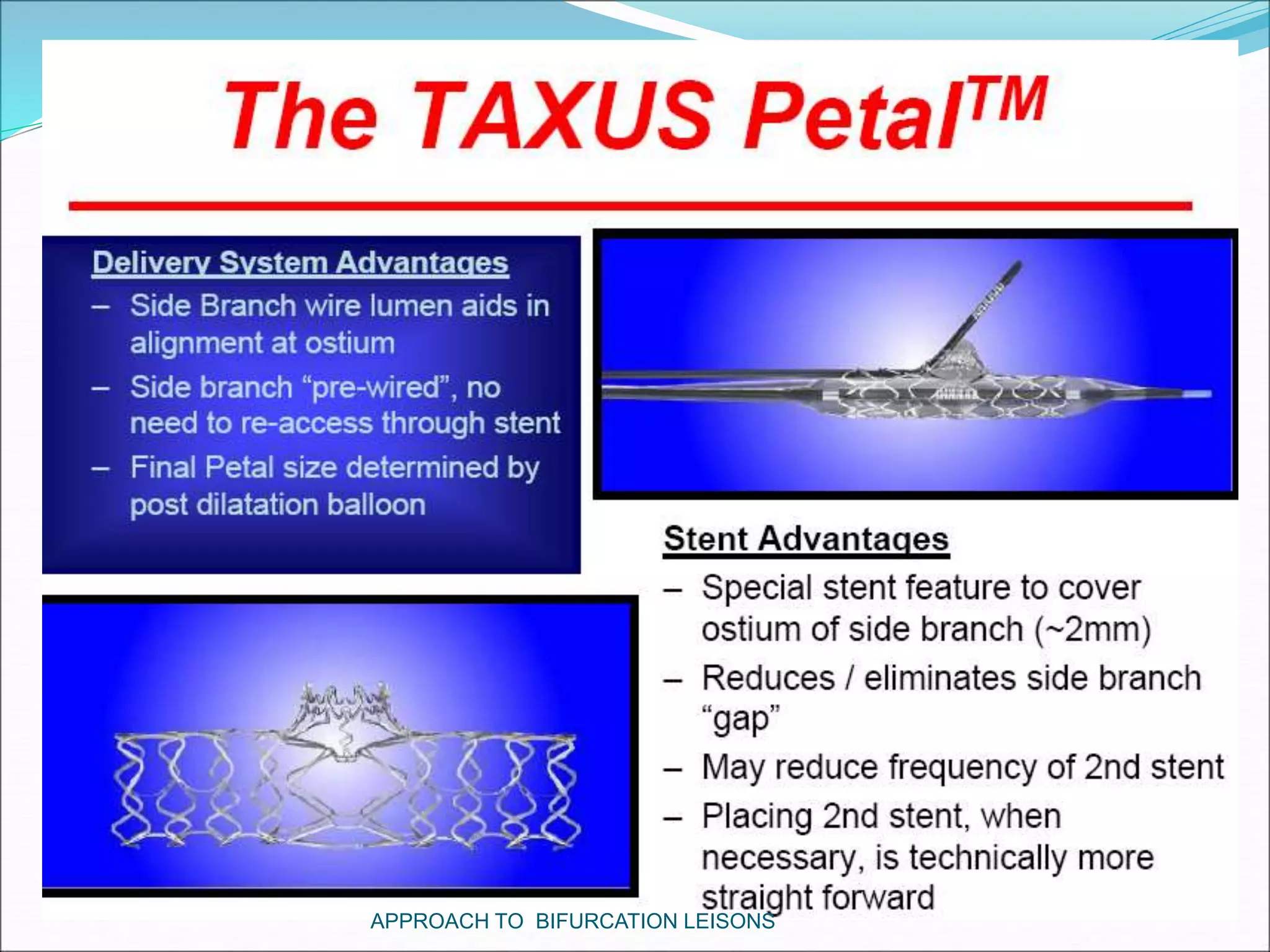 APPROACH TO BIFURCATION LEISONS
 