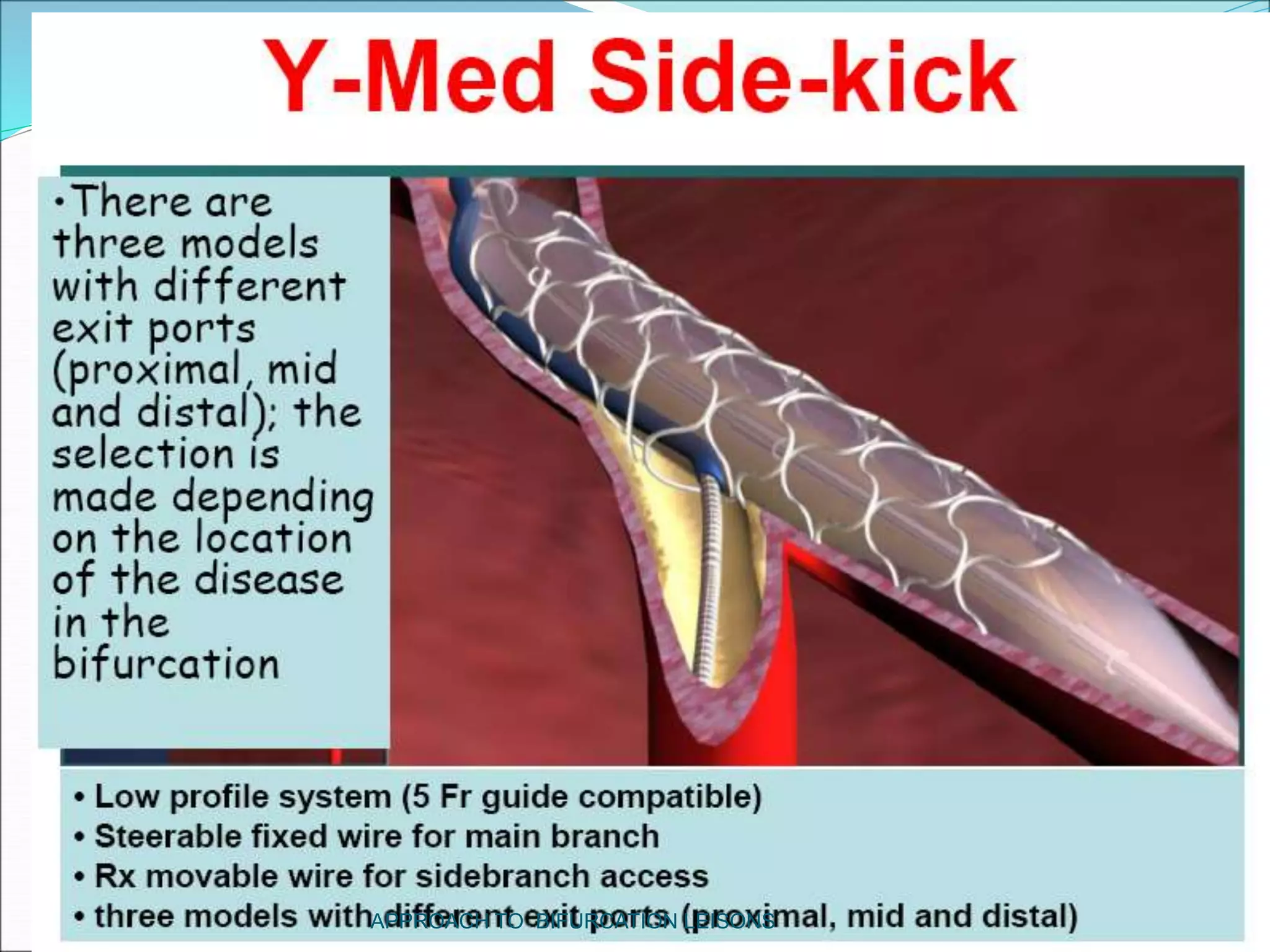 APPROACH TO BIFURCATION LEISONS
 