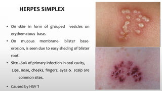 Pediatric Skin Diseases by Dr. Ramkesh Meena | PPTX