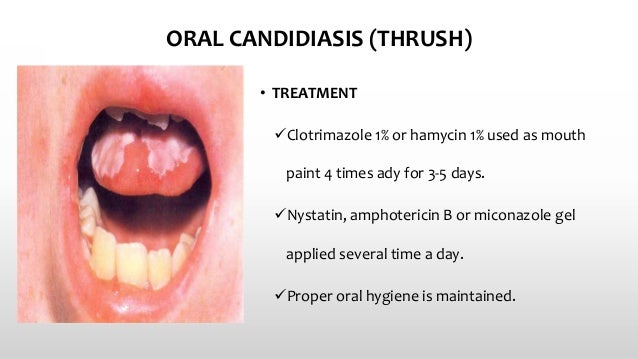 Side Effects of Diflucan Fluconazole Warnings Uses