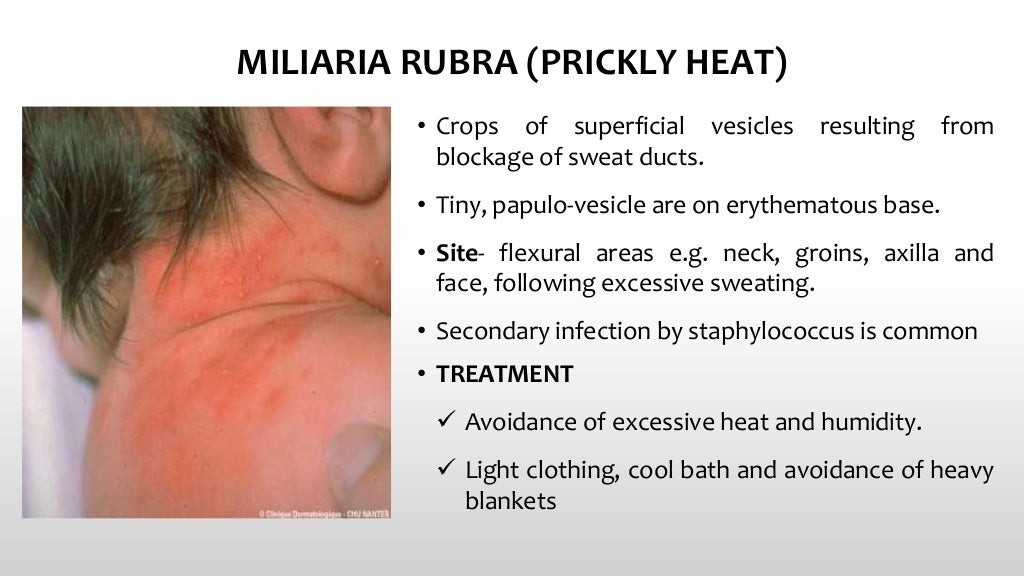 Pediatric Skin Diseases by Dr. Ramkesh Meena