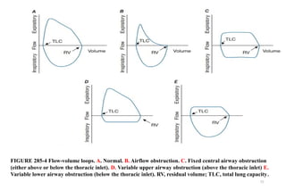 13
FIGURE 285-4 Flow-volume loops. A. Normal. B. Airflow obstruction. C. Fixed central airway obstruction
(either above or below the thoracic inlet). D. Variable upper airway obstruction (above the thoracic inlet) E.
Variable lower airway obstruction (below the thoracic inlet). RV, residual volume; TLC, total lung capacity.
 