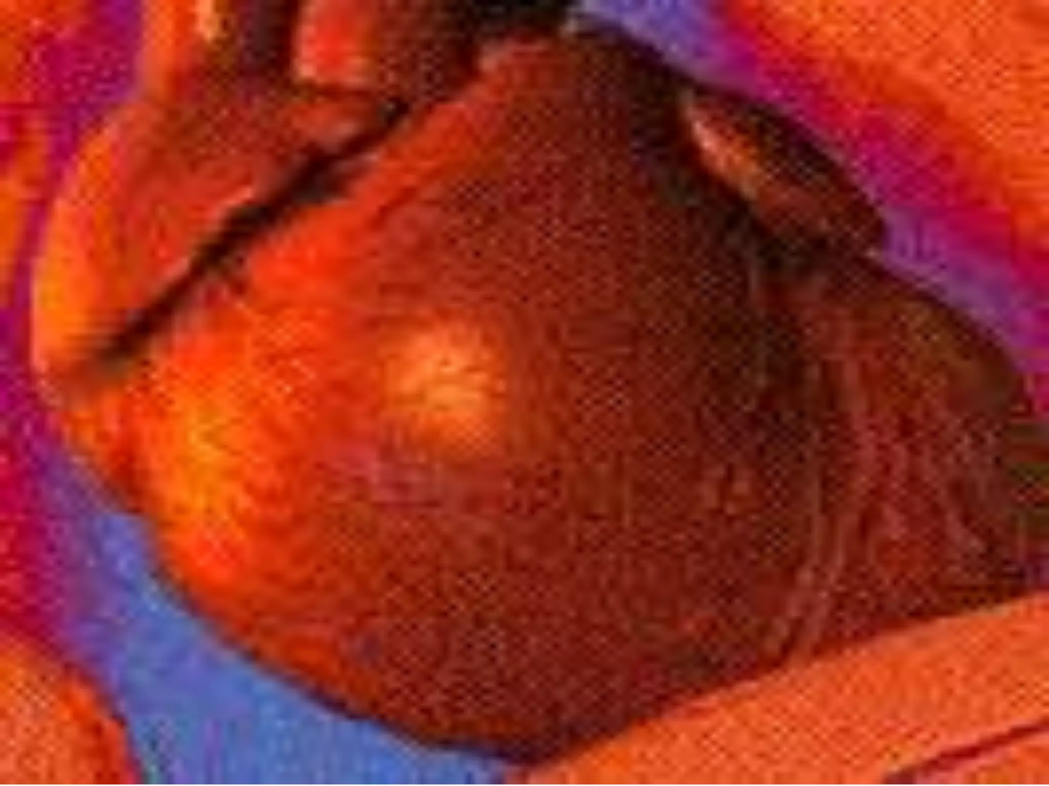 Apps of electrostatistics