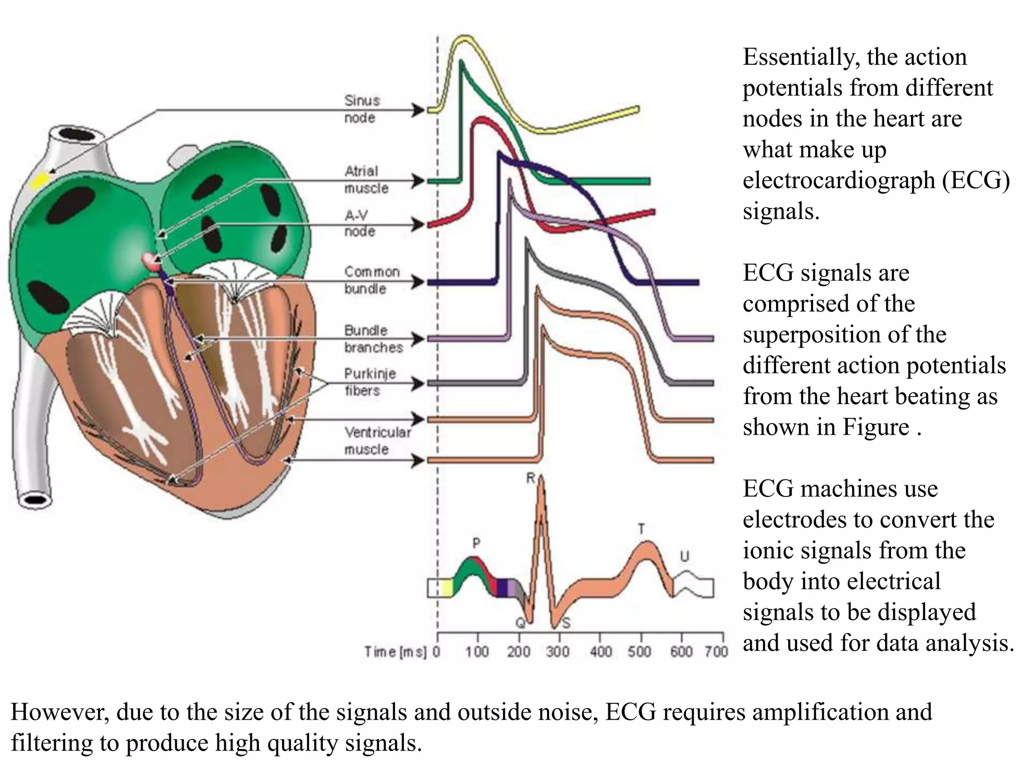 Essentially, the action
potentials from different
nodes in the heart are
what make up
electrocardiograph (ECG)
signals.
ECG signals are
comprised of the
superposition of the
different action potentials
from the heart beating as
shown in Figure .
ECG machines use
electrodes to convert the
ionic signals from the
body into electrical
signals to be displayed
and used for data analysis.
However, due to the size of the signals and outside noise, ECG requires amplification and
filtering to produce high quality signals.
 