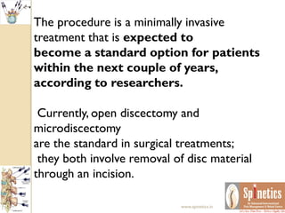 The procedure is a minimally invasive
treatment that is expected to
become a standard option for patients
within the next couple of years,
according to researchers.
Currently, open discectomy and
microdiscectomy
are the standard in surgical treatments;
they both involve removal of disc material
through an incision.
www.spinetics.in
 