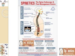 www.spinetics.in
 