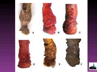 Dukes' club, April 2011 