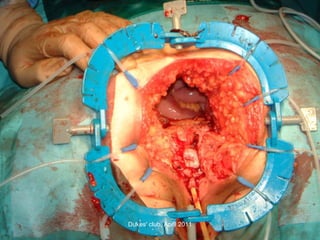 Dukes' club, April 2011 