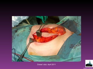 Dukes' club, April 2011 