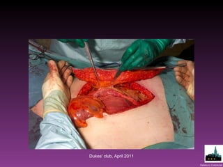 Dukes' club, April 2011 