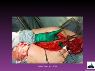 Dukes' club, April 2011 