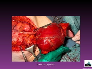 Dukes' club, April 2011 