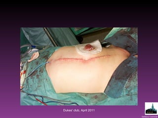 Dukes' club, April 2011 