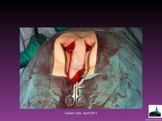 Dukes' club, April 2011 