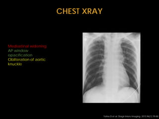 radiology traumatic injuries with schematic presentation | PDF