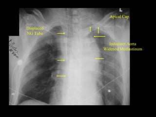 radiology traumatic injuries with schematic presentation | PDF