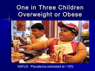 One in Three ChildrenOne in Three Children
Overweight or ObeseOverweight or Obese
NAFLD: Prevalence estimated at ~10%
 