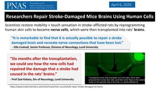 Scientists restore mobility + touch sensation in stroke-afflicted rats by reprogramming
human skin cells to become nerve cells, which were then transplanted into rats’ brains.
April 6, 2020
Researchers Repair Stroke-Damaged Mice Brains Using Human Cells
“It is remarkable to find that it is actually possible to repair a stroke
damaged brain and recreate nerve connections that have been lost.”
- Olle Lindvall, Senior Professor, Division of Neurology, Lund University
Transplanted nerve cells (transplant up to the right), which were
produced from human skin cells, send their nerve fibers to the cerebral
cortex on the opposite side of the brain in a stroke-afflicted rat.
“Six months after the transplantation,
we could see how the new cells had
repaired the damage that a stroke had
caused in the rats’ brains.”
- Prof Zaal Kokaia, Div of Neurology, Lund University
https://www.lunduniversity.lu.se/article/researchers-successfully-repair-stroke-damaged-rat-brains
 