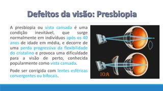 A presbiopia ou vista cansada é uma
condição inevitável, que surge
normalmente em indivíduos após os 40
anos de idade em média, e decorre de
uma perda progressiva da flexibilidade
do cristalino e provoca uma dificuldade
para a visão de perto, conhecida
popularmente como vista cansada.
Pode ser corrigida com lentes esféricas
convergentes ou bifocais.
 