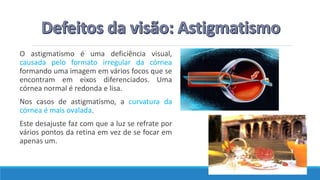 O astigmatismo é uma deficiência visual,
causada pelo formato irregular da córnea
formando uma imagem em vários focos que se
encontram em eixos diferenciados. Uma
córnea normal é redonda e lisa.
Nos casos de astigmatismo, a curvatura da
córnea é mais ovalada.
Este desajuste faz com que a luz se refrate por
vários pontos da retina em vez de se focar em
apenas um.
 