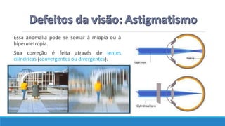 Essa anomalia pode se somar à miopia ou à
hipermetropia.
Sua correção é feita através de lentes
cilíndricas (convergentes ou divergentes).
 