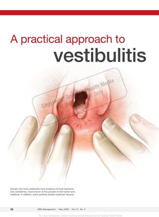 A practical approach to
                                            vestibulitis
                                                                                           ed        ia
                                                                       a             lt hM
                                                                 e n He only
                                                             owd      se
                                       ht D rsonal u
                                         ®
                                     ig
                                Copyr For pe




Women who have vestibulitis have evidence of focal erythema
and, sometimes, focal erosion at the junction of the hymen and
vestibule. In addition, some patients exhibit vestibular fissures.




52                         OBG Management | May 2009 | Vol. 21 No. 5


                             For mass reproduction, content licensing and permissions contact Dowden Health Media.
 