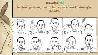 Ten hand postures used for testing imitation of meaningless
gestures
 