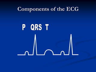 Components of the ECG
 