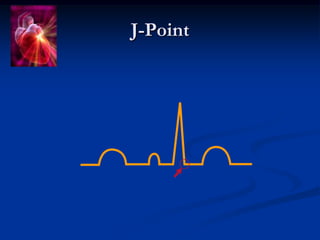 J-Point
 